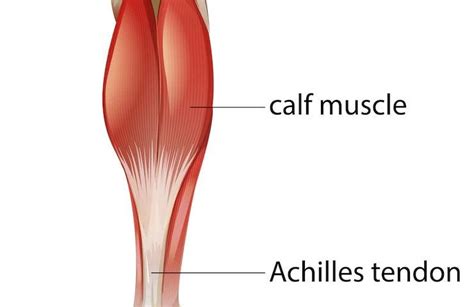 Two Types Of Achilles Tendon Repair Surgery Which Is Right For You