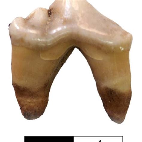 Detail Of The Maxillary Left Third Premolar Of A Dog Download