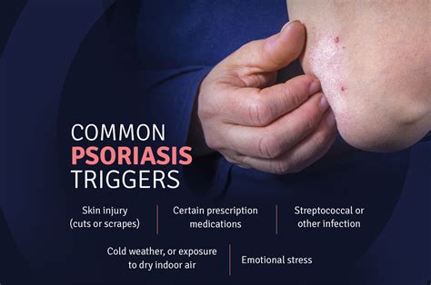 Common Psoriasis Triggers