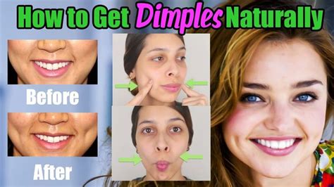 Pin On How To Get Dimples Naturally At Home Naturally Get Dimples Quick