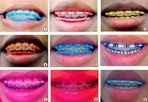 nice d braces colors cute braces teeth braces