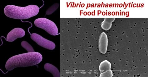 Vibrio Parahaemolyticus Food Poisoning Gastroenteritis