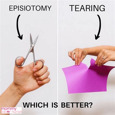 Episiotomy Vs Tearing Do You Know Which One Is Better