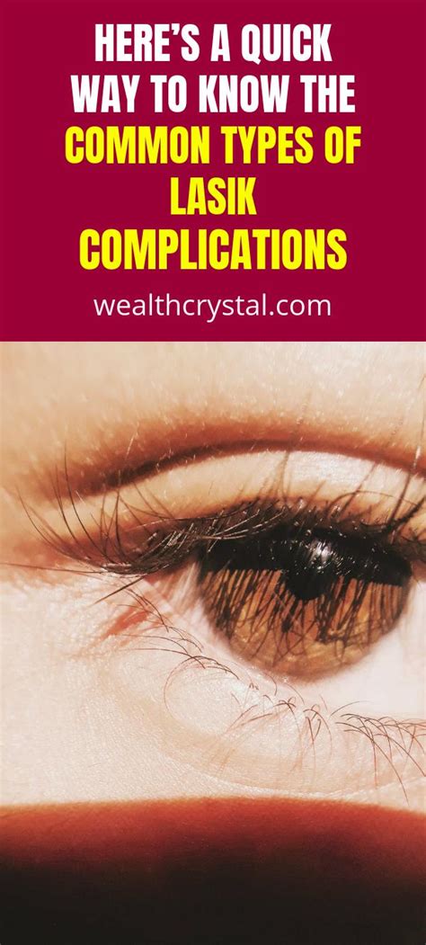 here s a quick way to know the common types of lasik complications wealth crystal