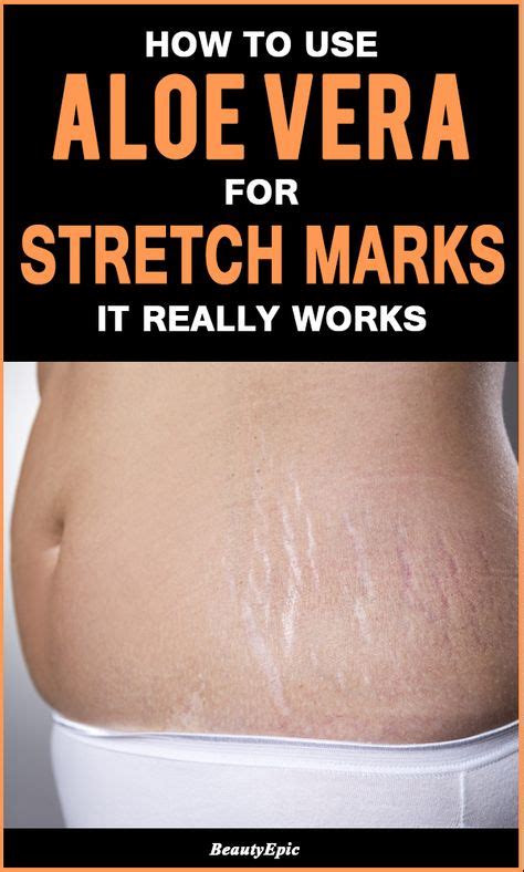 How To Use Aloe Vera To Get Rid Of Stretch Marks Fast Stretch Marks