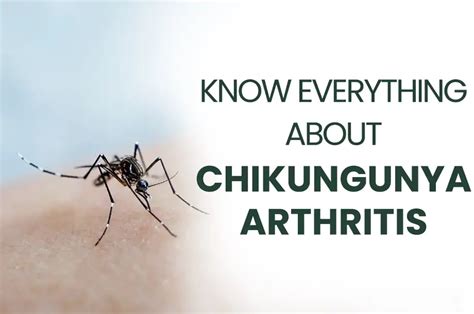 Chikungunya Arthritis Ayurvedic Treatment Dr Sharda Ayurveda