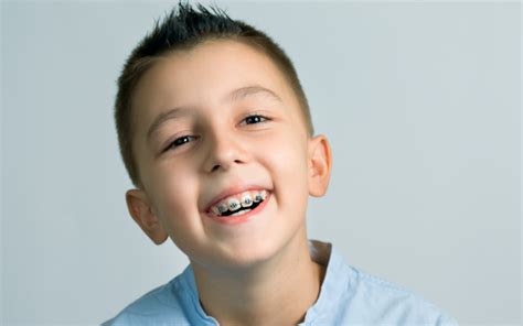 When Should Kids Get Braces How To Tell When Its Time For Braces