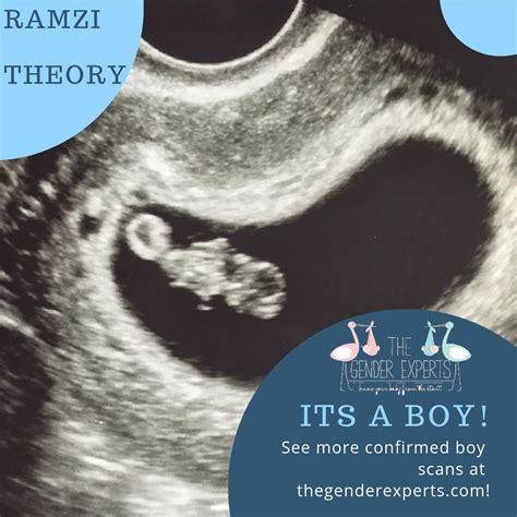 How To Tell Baby Gender From Ultrasound Picture 8 Weeks