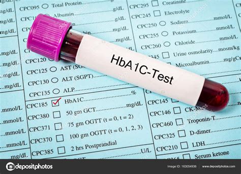 Hemoglobin A1c Test With Sample Blood Stock Photo By ©gamjai 163054936