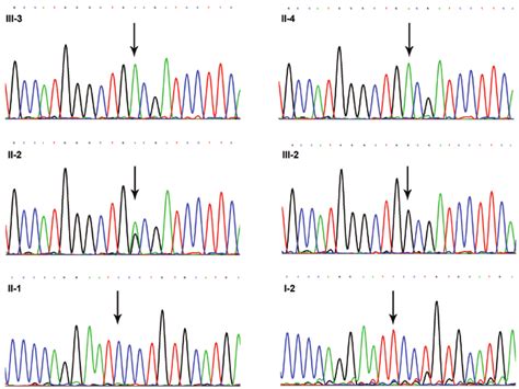 Mutation Analysis Of The Androgen Receptor Gene In The Probands And