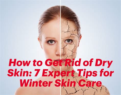 How To Get Rid Of Dry Skin 7 Expert Tips For Winter Skin Care In 2021