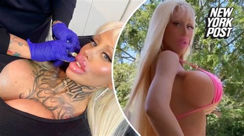 Woman Who Spent To Become Barbie Removes Tattoos So She Could Be More Plastic Looking