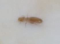 When i woke up the next morning i saw rashes and bites on please guide me as to how to clean up my laptop. entomology - I have a black tiny bug crawling all over the ...