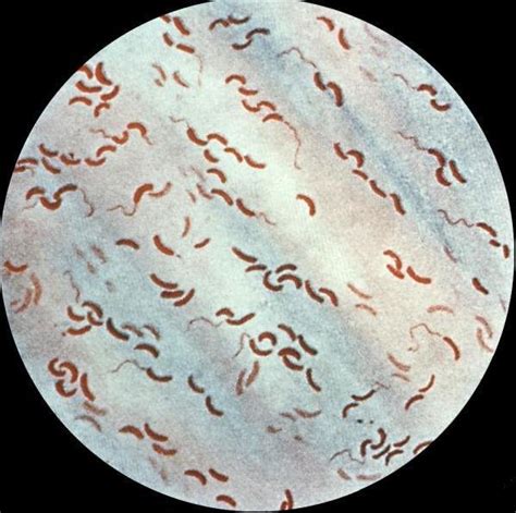 1 Vibrio Cholera Gram Stain Of Pure Culture Download Scientific Diagram