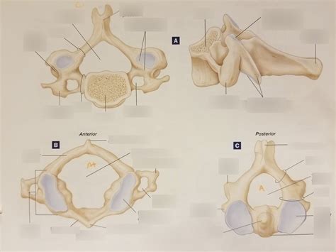 Cervical Vertebra Superior And Lateral Views Atlas And Axis Diagram