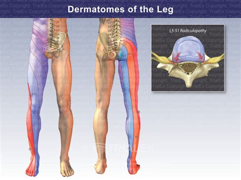 Dermatomes Of The Leg Trial Exhibits Inc