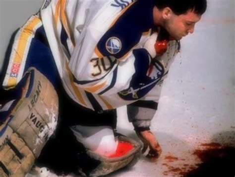 14 Gruesome Sports Injuries That Shocked Spectators Page