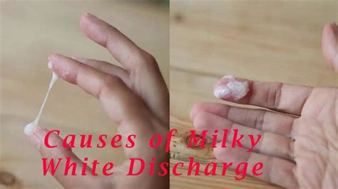 Is Thick White Discharge Early Sign Of Pregnancy Pregnancywalls