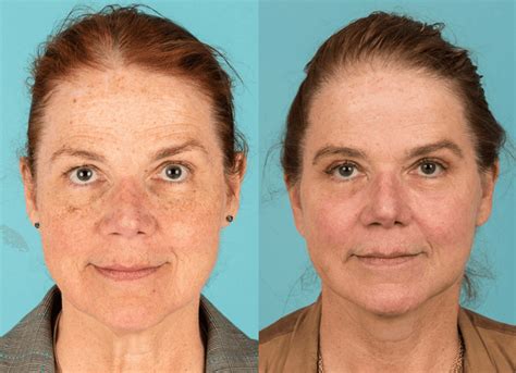 Coastal Facial Plastic Surgery And Aesthetics Reconstructive Plastic
