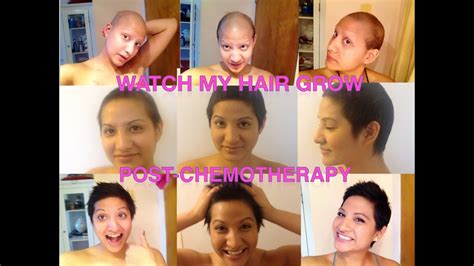 Top 100 Image Hair Growth After Chemo Thptnganamst Edu Vn