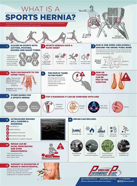 Sports Hernia Infographic I made #SportsInjuries | Sports injury, Sports therapy, Sports medicine