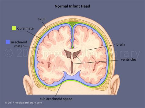 Check spelling or type a new query. Infant Brain Coronal View - Medical Art Library