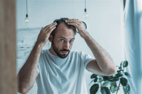 Early Signs Of Hair Loss