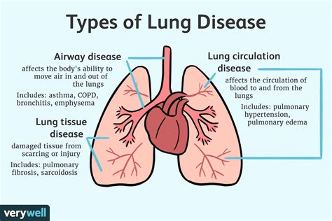 Different Types Of Lung Diseases Hot Sex Picture
