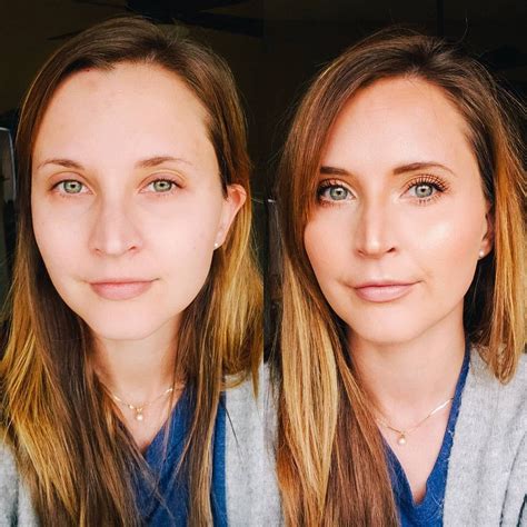 Maskcara Beauty Before And After Maskcara Beauty Beauty Maskcara