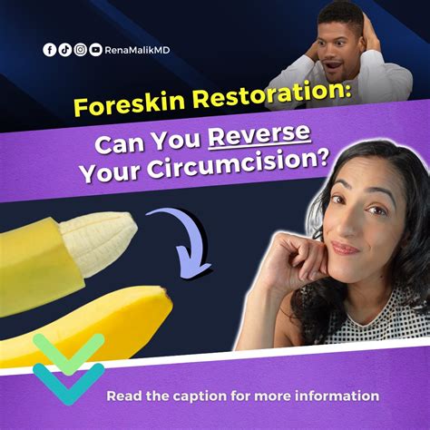 Rena Malik Md Urologist On Twitter Foreskin Restoration Can You