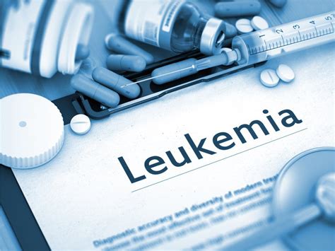 16 Silent Signs Of Leukemia You Shouldnt Ignore Best Health Canada