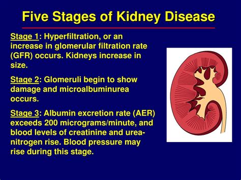 Diabetes mellitus, microangiopathy, diabetic nephropathy, diabetic retinopathy, developmental. PPT - Diabetic Nephropathy PowerPoint Presentation, free ...