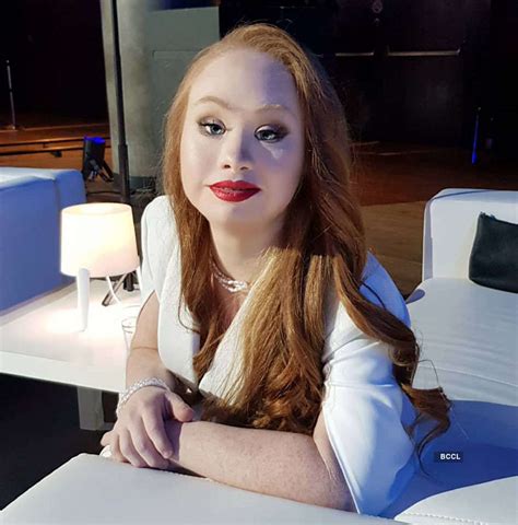 meet madeline stuart world s 1st supermodel with down syndrome photogallery etimes