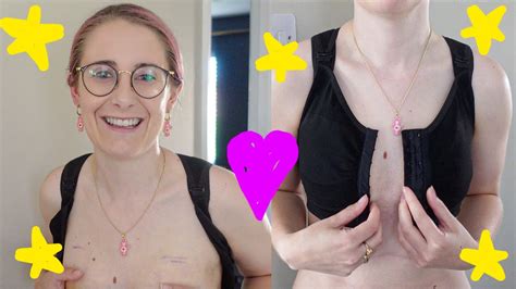 Seeing My Scars For The First Time After My Double Mastectomy 💜 Youtube