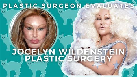 Jocelyn Wildenstein Plastic Surgery Before And After Catwoman Evaluated By Plastic Surgeon