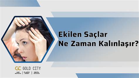 Ekilen Saçlar Ne Zaman Kalınlaşır - Gold City Premium Saç Ekimi Acıbadem