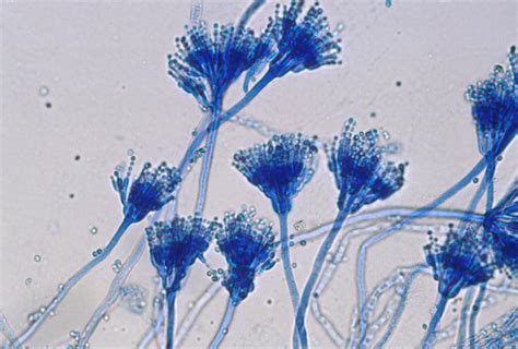 Lactophenol Cotton Blue Lpcb Principle And Procedure For Fungal