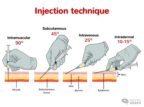 Injection Techniques Food And Health Pitribe