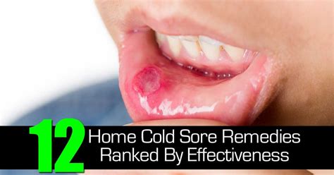 | home remedy for cold sore tingling or itching around the lips is a distressing signal that a cold sore is on its. 12 Home Cold Sore Remedies Ranked By Effectiveness