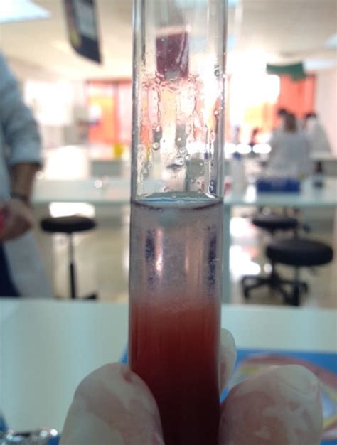 Post de Samara y Ofelia Extracción de ADN de la fresa Ciclo Anatomia