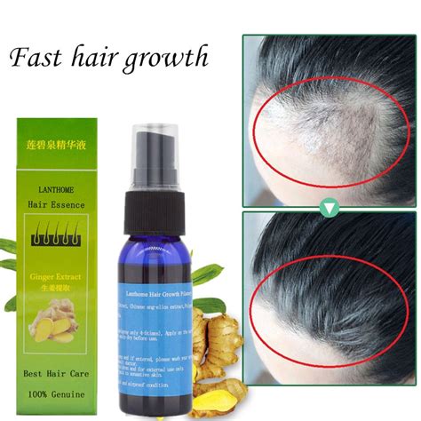 Effective hair loss products for black hairs. 100% Effective Anti Hair Loss Hair Growth Liquid Spray for ...