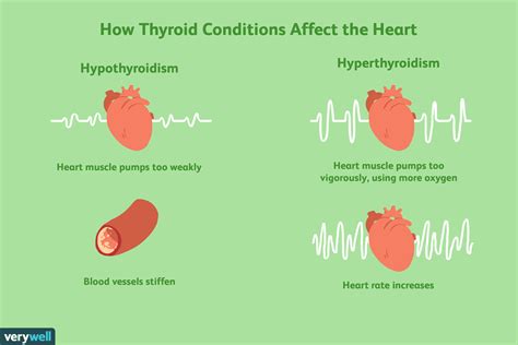 How Does Thyroid Disease Affect The Heart