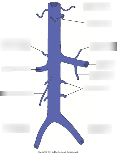 Chapter 10 Figure 10 02 Inferior Vena Cava And Major Tributaries