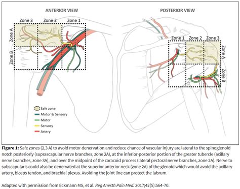 How I Do It Shoulder Articular Nerve Blockade And Radiofrequency Ablation