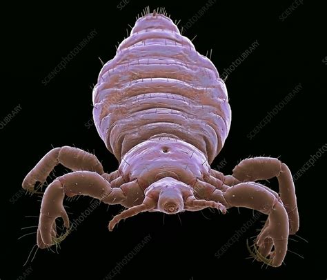 Head Louse Sem Stock Image C Science Photo Library
