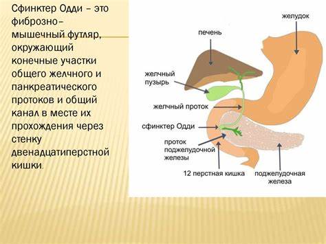 Диета дисфункция сфинктера одди Хронический холецистит, дисфункция желчного пузыря, спазм сфинктера Хронический холецистит, дисфункция желчного пузыря, спазм сфинктера Диета дисфункция сфинктера одди