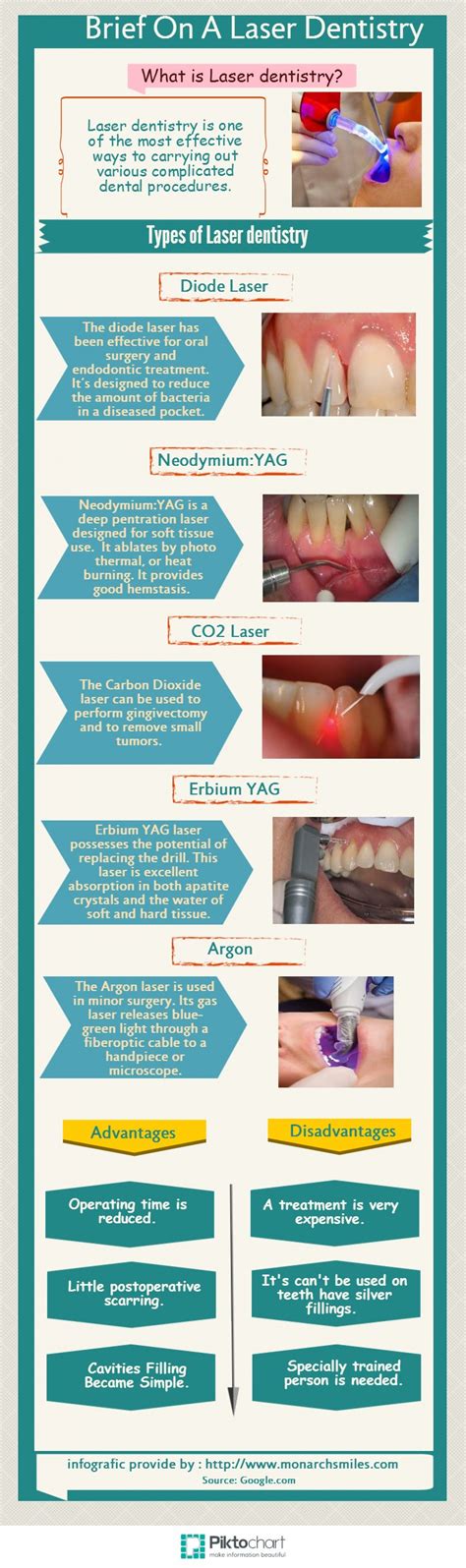Brief On A Laser Dentistry Infographic Visual Ly Laser Dentistry