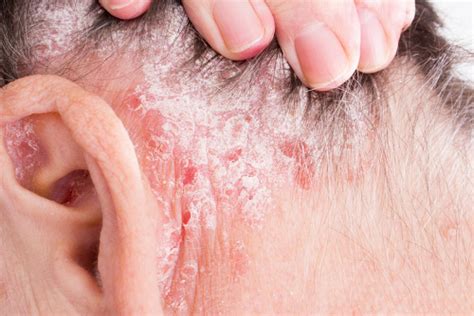 Rash Behind The Ear 5 Causes And Treatments