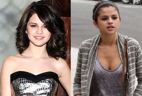 selena gomez before and after plastic surgery 06 celebrity plastic surgery online