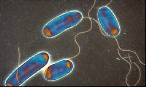 It's caused by the bacterium legionella pneumophila found in both potable and nonpotable water more hospitals are facing the dilemma of legionella outbreaks as they discover the drinking water is. Foto: Legionella (spp) di Interlabor Srl #66391 - Habitissimo